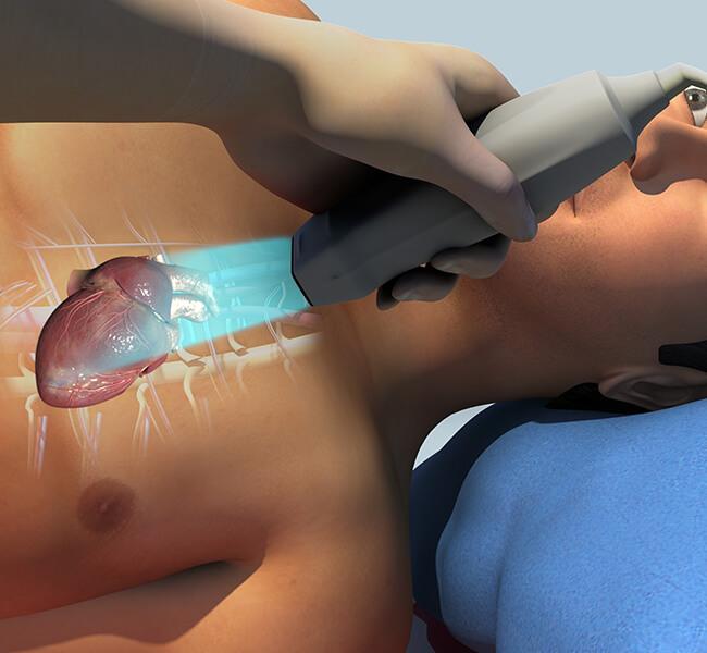 Medax Diagnostics Echodiagram